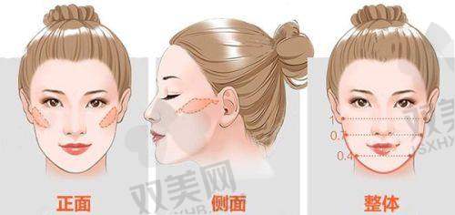 开封启美整形眼整形价格对比优势