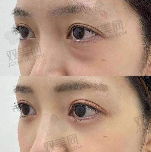 用户反馈如何？好评还是“踩雷”？