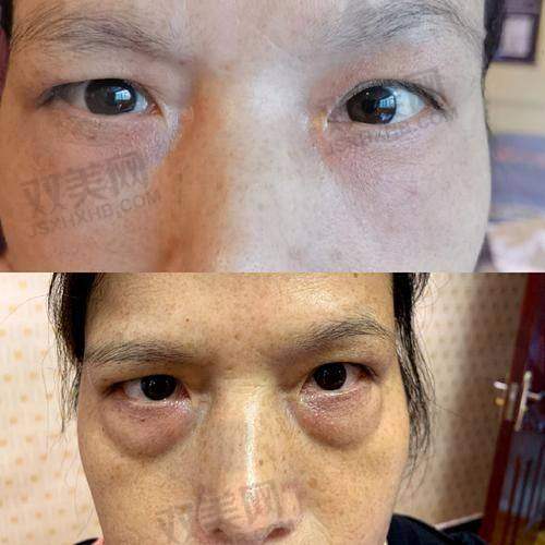 杭州健丽医疗美容价格表来啦！