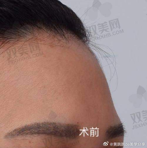 如何降低手术风险