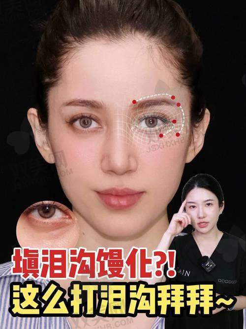 填充成效