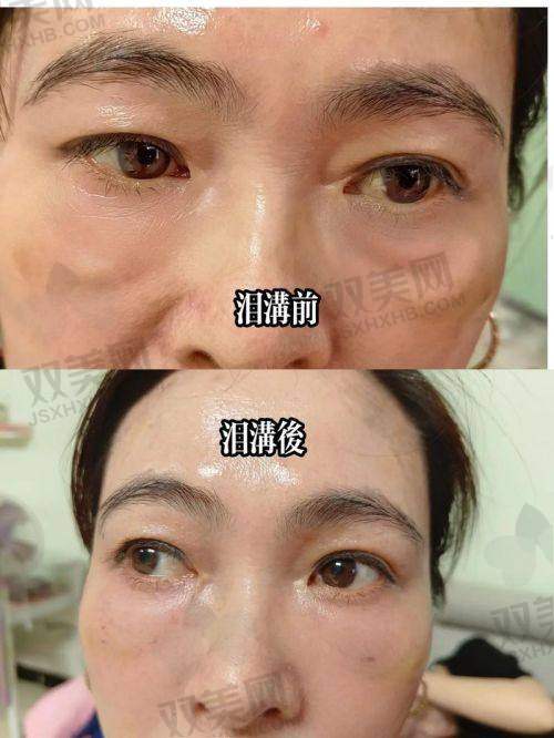 填充过程