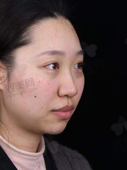杏枝山的优势是什么