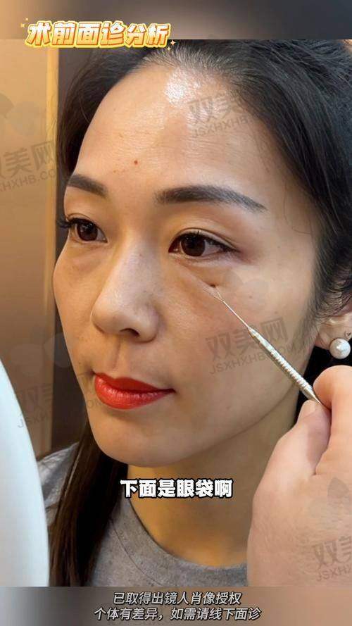 写在文末：医美虽美，选择合适才更重要