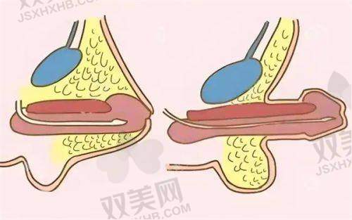 真实实例见证成效