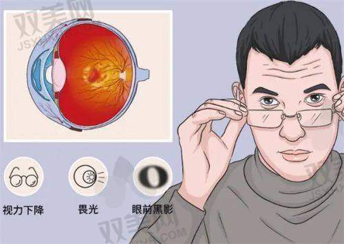 葡萄膜炎领域排名前三！她的手术到底“稳”在哪里？