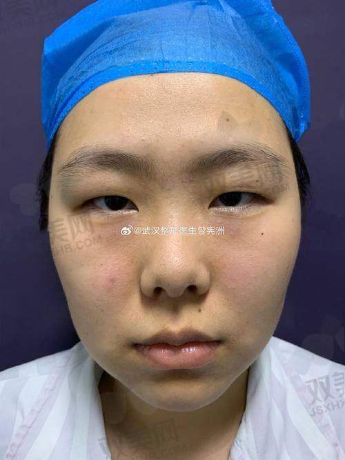 2. 深圳曹孟君医疗美容门诊部