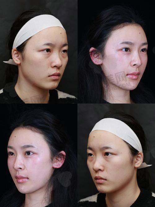 医美消费转变趋势：从“跟风”到“懂自己”