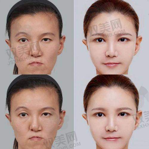 总结与询问引导