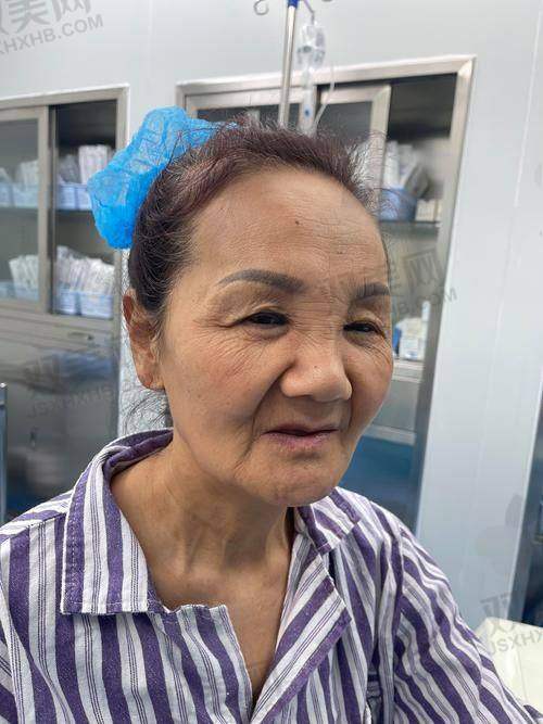 术后修复，成效逐渐显现