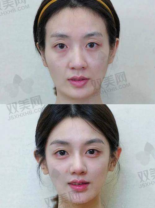 二、选择医美机构和医生