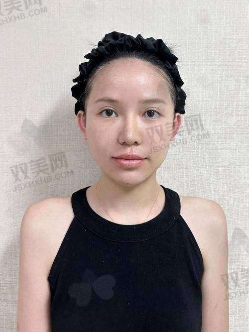 九、写在末尾：怡秀玻尿酸值不值得入？