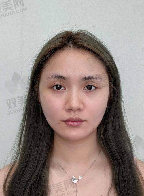 ?‍? 普丽妍童颜针适合哪类人群？憋盲冲，看完再决定！