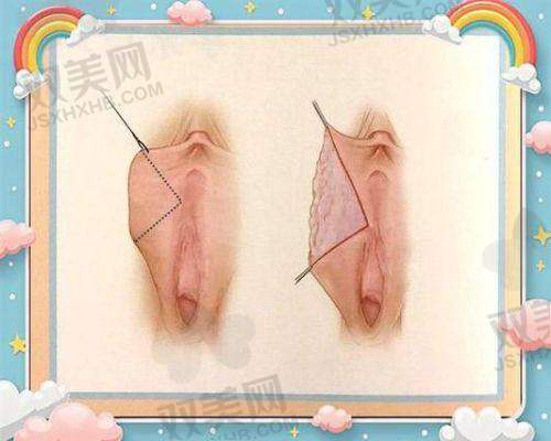 尾声：私密问题不再是秘密，现在就是改变的一步