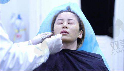 前后对比照