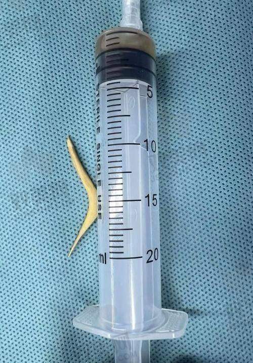 ? 结语：不是所有的异物都能凑合，越早选队越好走