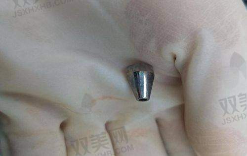 ? 易踩坑医院避雷Tips：小心工作室与渠道医院陷阱
