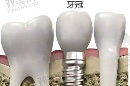 泉州美特尔口腔在服务体验上如何？价格外还有“人情味”