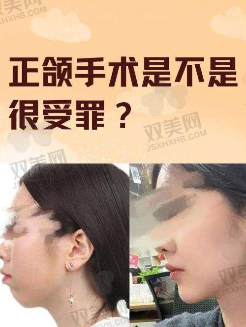 热门问题：排队多久？为何一定要提前预约？