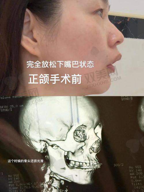 广州广大医院正颌手术在线预约攻略，适合不差流量的现代人！