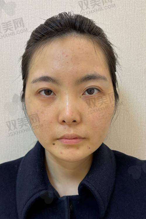 打水光前别忽视这几点，“小白坑”躲开才能美得不翻车
