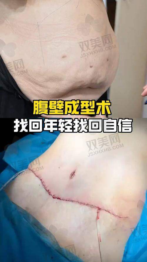 NO.5 北京中日友好医院整形美容科