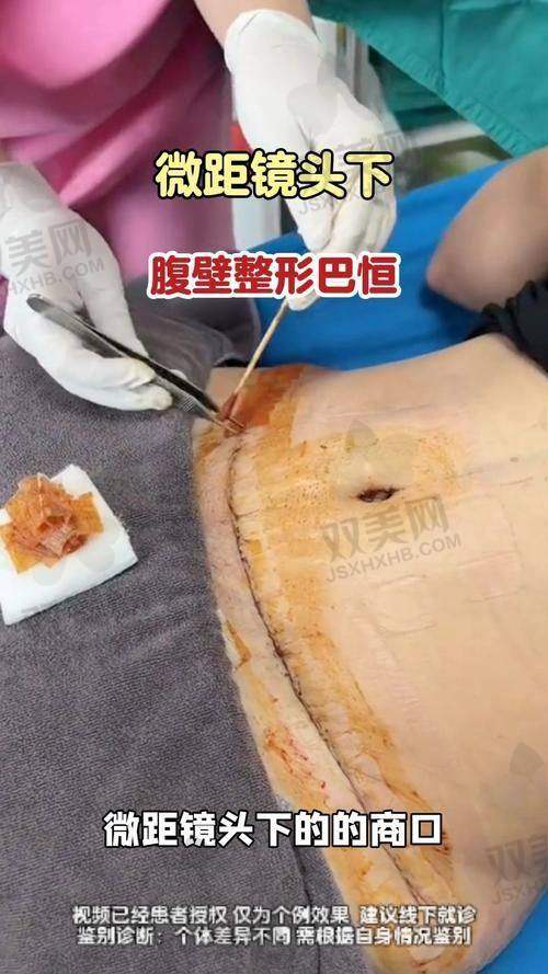 NO.2 北京米兰柏羽丽都整形美容医院
