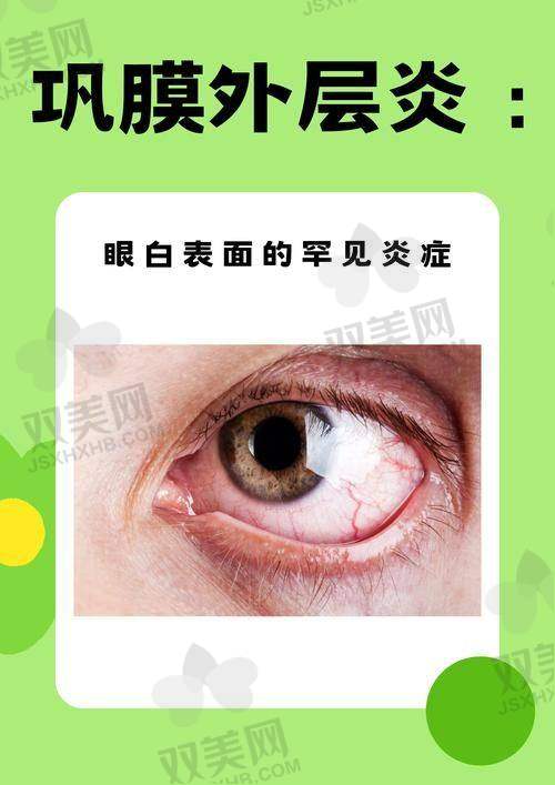 【邢台眼科医院是正规的吗】