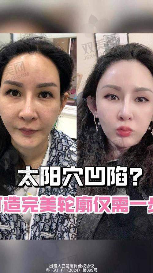 不同填充材料的维持时长