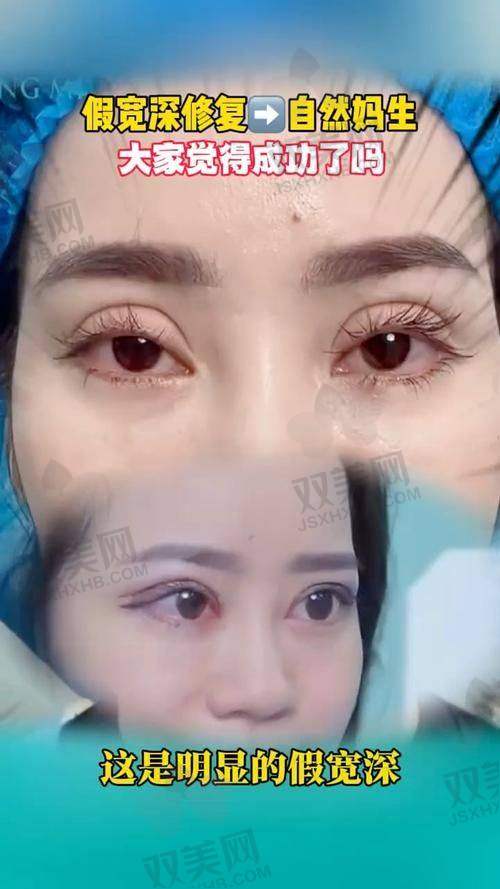 排名十：付毅医生 | 坐诊医院：武汉中翰整形外科医院