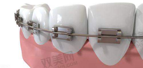 乌鲁木齐双宝口腔医院收费标准