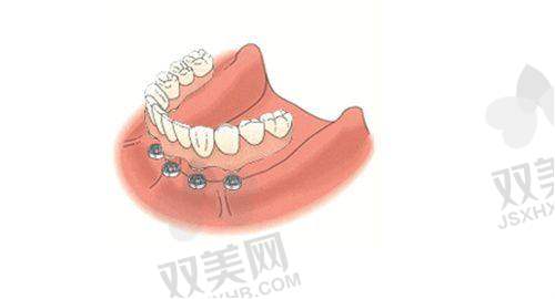 牙齿矫正项目价格详情