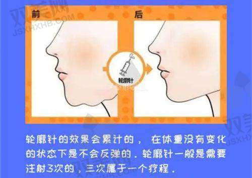 注射过程