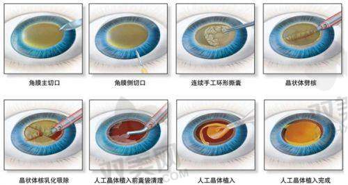 二次更换晶体的常见误区