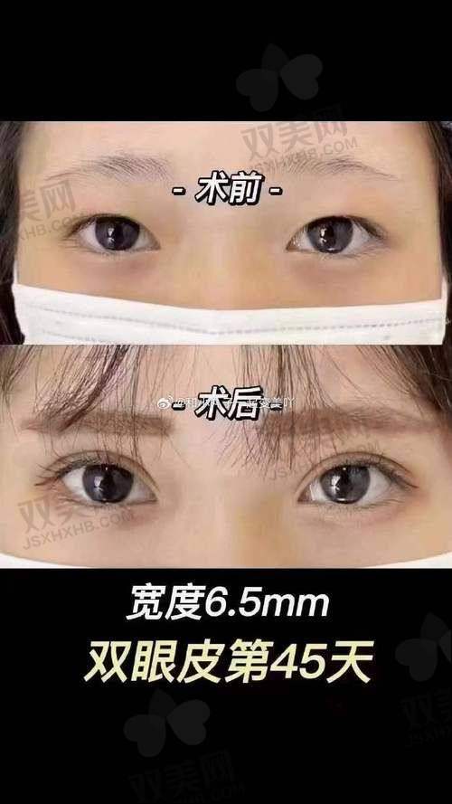 面诊体验