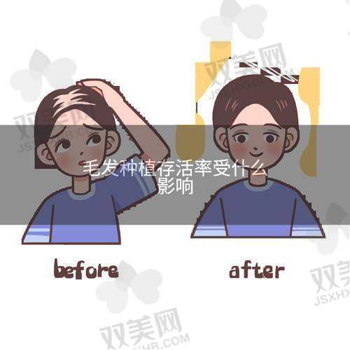 植发成效，惊艳来袭