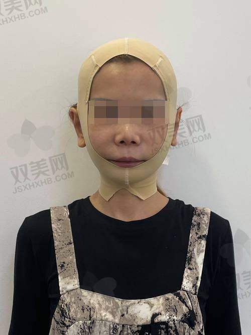 四、李健钢医生靠谱吗？为啥大家都信得过他？