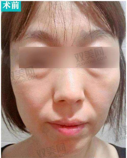 总结：谢宏彬挂号其实没你想的难，难的是信息不透明！