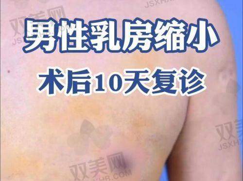 2025年度福州十大隆胸正规整形医院榜单出炉