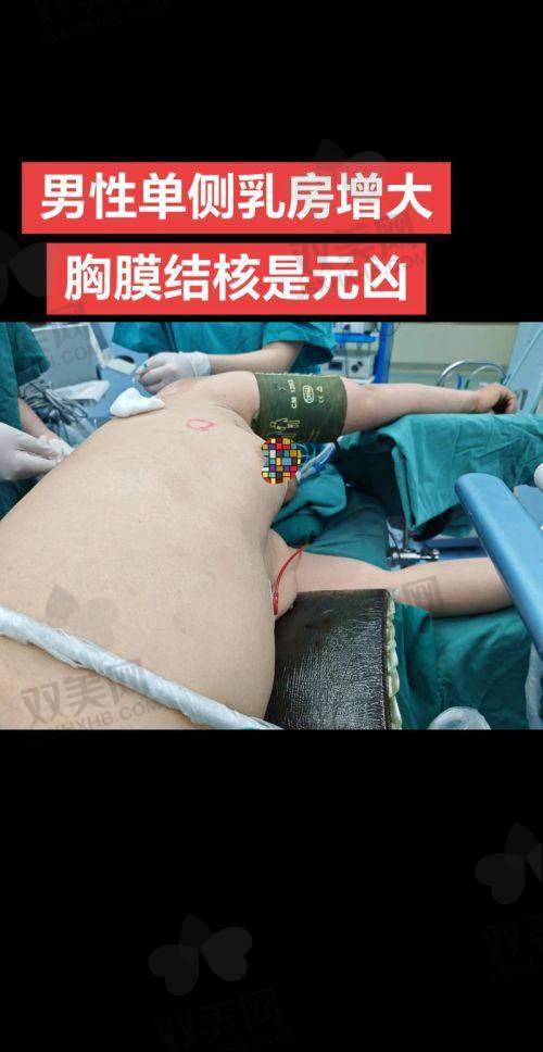术后小姐姐的美丽逆袭，就是你超强的种草源
