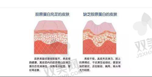 提升手术价格详表