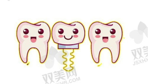二、沈阳国民口腔单颗种植牙价格大全：从入门到优质款，总有适合你的
