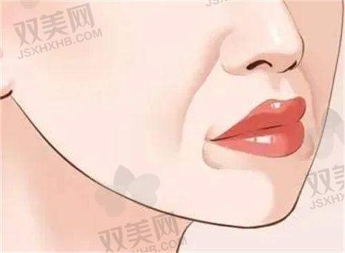 填充后的护理要点