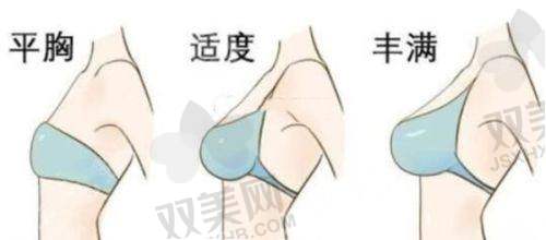 面部凹进去填充的维持时长是多久？