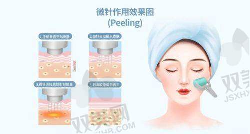 法令纹纹的风水说法