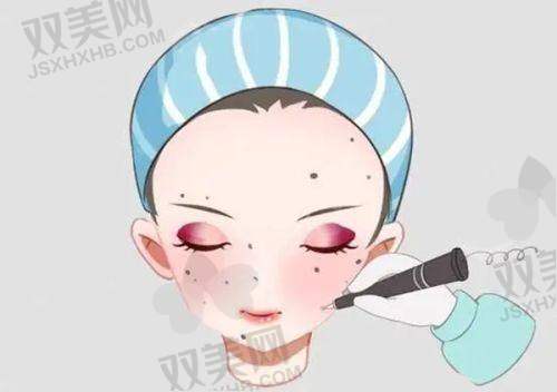 注射美容玻尿酸后的注意事项