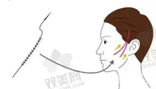 实例背后的成效与风险