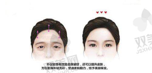 饮食调理助消纹