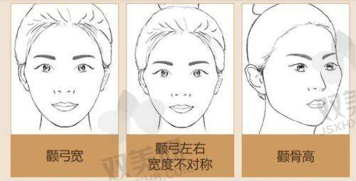 饮食调理改善抬头纹