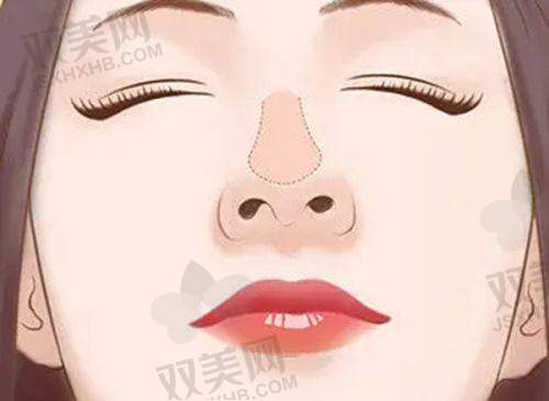 感染风险